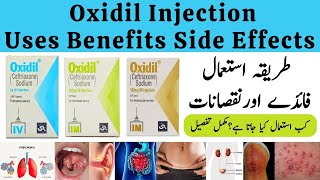 Oxidil Injection Used For In Urdu  Oxidil Injection 500mg [upl. by Dickey]