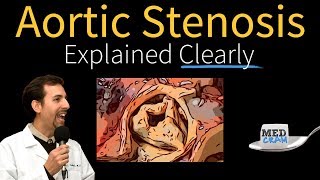 Aortic Stenosis Explained Clearly  Diagnosis and Treatment [upl. by Odnumyer]