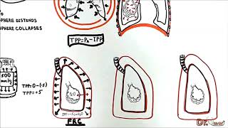 Transmural Pressures transpulmonary transthoracic transrespiratory pressure [upl. by Nodnahs579]