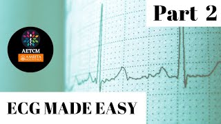 ECG made easy  Part 2 Rhythm Analysis [upl. by Ehtyde84]