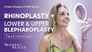 Rhinoplasty amp Blepharoplasty Patient Testimonial  rhinoplasty rhinoplastyturkey blepharoplasty [upl. by Isiah]