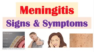 Meningitis Signs and Symptoms amp Why They Occur [upl. by Maite]