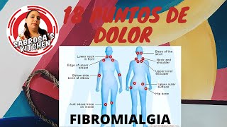 Los 18 puntos de dolor de la Fibromialgia [upl. by Austen13]