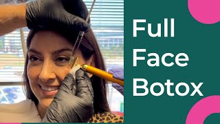 The Full Face Botox TreatmentThe RJR Method [upl. by Dimitris619]