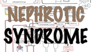 Nephrotic Syndrome  Overview Sign and symptoms pathophysiology [upl. by Dolph]