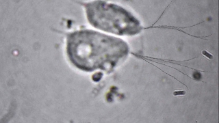 Trichomonas vaginalis flagella  wici rzęsistka pochwowego [upl. by Cariotta456]