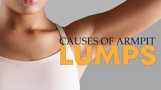 How To Treat Your Symptoms And Understand The Causes Of Armpit Lump  Tiggio [upl. by Oileduab]