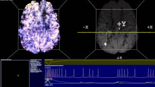 Simulation of Thalamocortical Brain Network  Spiking Neural Network 14M Neurons 140M Synapses [upl. by Lahcar]