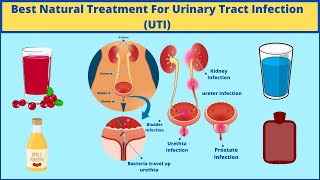 Best Urinary Tract Infection UTI Treatment At Home Quickly  Natural Remedies for UTI Men amp Women [upl. by Embry40]