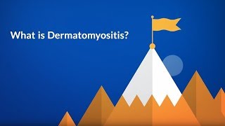 What is Dermatomyositis Inflammatory Disease [upl. by Ayimat217]