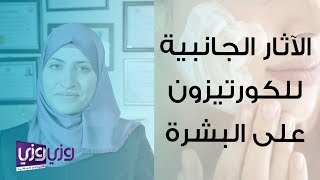 الآثار الجانبية للكورتيزون على الجلد والوجه [upl. by Ynnub]