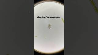 Amoeba death in the microcosmos death microscope fyp sad tragic nature microscopic science [upl. by Tenay]