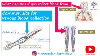 Common venipuncture sites  Venipuncture sites that need expertise  Medical Lab Tech [upl. by Gar]