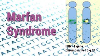 Marfan Syndrome  Heart Skeletal amp Eye Complications  Connective Tissue Disorder [upl. by Raye714]