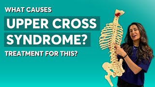 What Causes Upper Cross Syndrome amp What Treatments are Available [upl. by Navak]