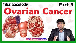 Ovarian Cancer Part 3  Obstetrics and gynaecology Video lectures  Medvizz app [upl. by Nilauqcaj]