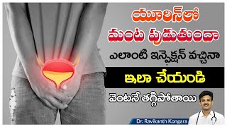 What Causes of Urine Infection  Frequent Urination  Diabetic Patients  Dr Ravikanth Kongara [upl. by Euqinwahs423]