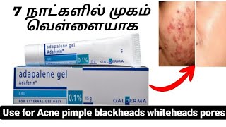 Adapalene gel uses in tamil  best oilment to reduce pimple and acne  skin whitening cream [upl. by Spiers]