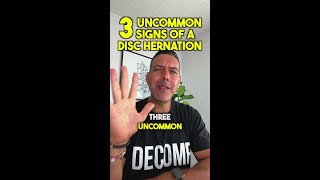 Hidden Signs of Disc Herniation [upl. by Fishman170]