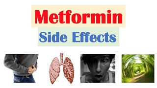 Metformin Side Effects amp Consequences [upl. by Janela]