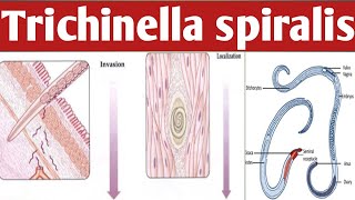 How Trichinella Spiralis Can Transform Your Body Ahmaric Tutorial [upl. by Attennot]