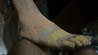 TRUETAPE® Hallux Valgus  Turf Toe  Taping Instruction [upl. by Seerdi720]