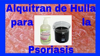 ⚱⚱ Alquitrán de Hulla para la Psoriasis ⚱⚱ [upl. by Ablasor]