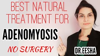 Best Natural Treatment For Adenomyosis Without Surgery DREESHA  Whatsapp 9814955510 [upl. by Madaih]