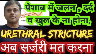 urethral stricture treatment with homeopathic medicines [upl. by Aaberg]