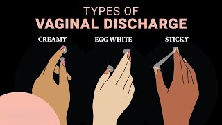 What Your Vaginal Discharge Reveals About Your Health [upl. by Euqor]