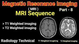 MRI  Part  8  MRI Sequences  T1 Weighted Imaging amp T2 Weighted Imaging   By BL Kumawat [upl. by Vasiliki]