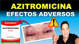 AZITROMICINA ¿Cómo se debe tomar ¿Cuáles son sus efectos adversos [upl. by Anwahsal]