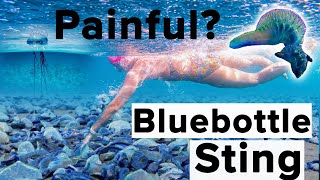 How Painful is a Bluebottle Sting  Ask Sarah Ferguson Open Water Swimming Questions [upl. by Reifinnej954]