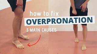 Pronated Feet and How to Fix 3 Different Causes of OVERPRONATION [upl. by Aimit]