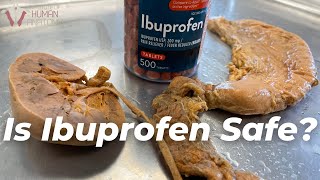 What Ibuprofen Does to the Body [upl. by Lennad]