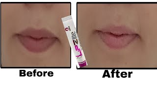 Lip Lightening cream Lipzlite Cream Review How to use lipzlite cream 100 Result Skin Lightening [upl. by Eniarral970]