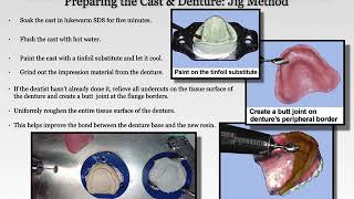 Complete Denture Reline amp RebaseImmediate Denture Surgical Template [upl. by Worsham]