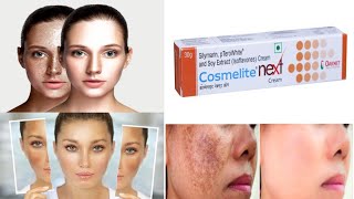 Cosmelite Next cream के फायदे हिंदी में cosmelite next cream किस काम आता है [upl. by Alyssa]