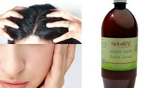 Top 5 ways to use Amla Juice  Benefits of amla juice in skincare haircare amp health [upl. by Namreg435]