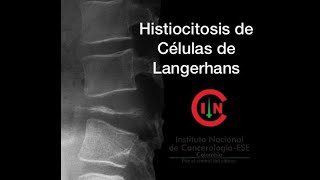 Histiocitosis de Células de Langerhans Dra Tamy Ron UNAL [upl. by Aihsiyt298]