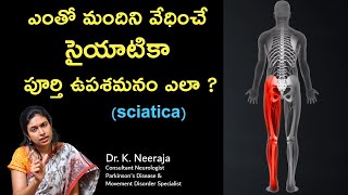 What Causes Sciatica Pain and How to Get Rid of It  Dr K Neeraja  Guntur  Chirala  Tenali [upl. by Adnawal]