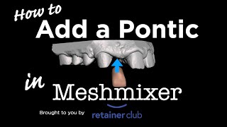 How to add a Pontic Tooth using Meshmixer [upl. by Isolt]