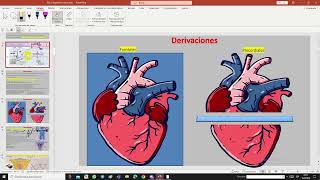 Arti 2 semana 9 electrocardiograma basico [upl. by Karil255]