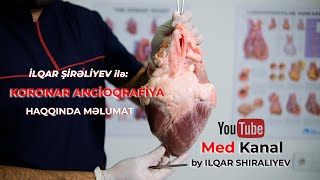 İlqar Şirəliyev ilə koronar angioqrafiya haqqında məlumat [upl. by Suoivatram]