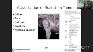 Paediatric Brainstem Tumours Dr Lissa Baird Boston Childrens amp MDT RoundTable Discussion [upl. by Madancy]