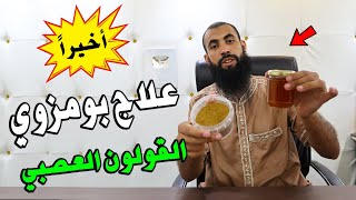 أخيرًا  علاج القولون العصبي  بومزوي  وصفة مجربة وفعالة بإذن الله [upl. by Noyes215]