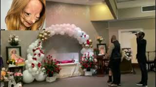 Adalia Rose last journey video Adalia Rose has passed away [upl. by Damalas]