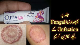 Cutis Cream for skin Fungal InfectionBest AntiFungal cream [upl. by Neel563]