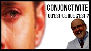 Conjonctivite questce que cest [upl. by Adnirb]