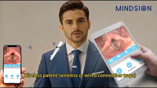 Vision Medical Endoscope Bringing Technology to Health [upl. by Martijn]